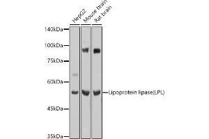 Western blot analysis of extracts of various cell lines, using Lipoprotein lipase (LPL) antibody (ABIN7268286) at 1:1000 dilution. (Lipoprotein Lipase 抗体  (AA 124-475))