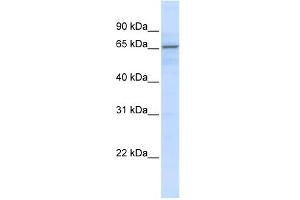 WB Suggested Anti-ZNF256 Antibody Titration:  0. (ZNF256 抗体  (N-Term))