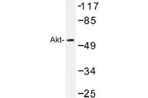Image no. 1 for anti-V-Akt Murine Thymoma Viral Oncogene Homolog 1 (AKT1) antibody (ABIN317784) (AKT1 抗体)