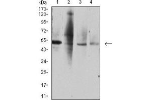 Western blot analysis using TNFRSF10D mouse mAb against A549 (1), HL-60 (2), MOLT4 (3), and CHO3D10 (4) cell lysate. (DcR2 抗体  (AA 56-211))