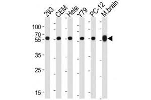 Western Blotting (WB) image for anti-Tubulin, beta 1 (TUBB1) antibody (ABIN3029340)