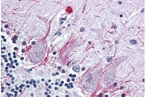 Brain, cerebellum, Human: Formalin-Fixed, Paraffin-Embedded (FFPE) (PTH2R 抗体  (N-Term))