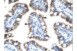 Image no. 3 for anti-Activating Transcription Factor 2 (ATF2) (AA 401-450) antibody (ABIN202679) (ATF2 抗体  (AA 401-450))