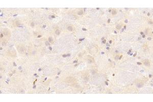 Detection of SNCa in Rat Cerebrum Tissue using Polyclonal Antibody to Synuclein Alpha (SNCa) (SNCA 抗体  (AA 23-140))