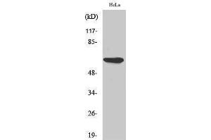 Western Blotting (WB) image for anti-Protein Kinase, AMP-Activated, alpha 1 Catalytic Subunit (PRKAA1) (Thr280) antibody (ABIN3183270)