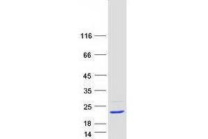 Validation with Western Blot
