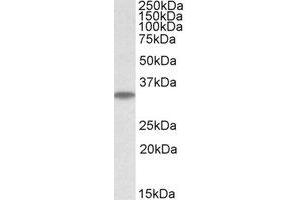 Western Blotting (WB) image for anti-Microtubule-Associated Protein, RP/EB Family, Member 3 (MAPRE3) (Internal Region) antibody (ABIN2464598) (MAPRE3 抗体  (Internal Region))