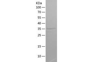 Western Blotting (WB) image for Chromosome X Open Reading Frame 61 (CXORF61) (AA 22-113) protein (His-IF2DI Tag) (ABIN7282296) (CXORF61 Protein (AA 22-113) (His-IF2DI Tag))