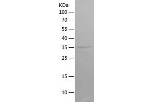 CXORF61 Protein (AA 22-113) (His-IF2DI Tag)