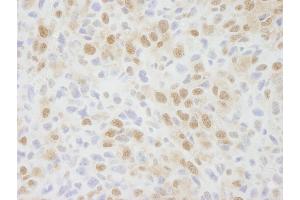 Immunohistochemistry (IHC) image for anti-Zinc Finger Protein 335 (ZNF335) (C-Term) antibody (ABIN7448692) (ZNF335 抗体  (C-Term))
