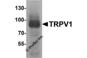 Western Blotting (WB) image for anti-Transient Receptor Potential Cation Channel, Subfamily V, Member 1 (TRPV1) (C-Term) antibody (ABIN1077423) (TRPV1 抗体  (C-Term))