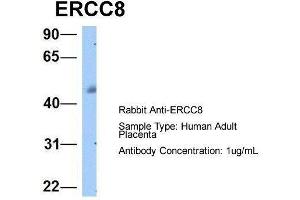 Host:  Rabbit  Target Name:  ERCC8  Sample Type:  Human Adult Placenta  Antibody Dilution:  1. (ERCC8 抗体  (C-Term))