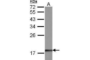 WB Image Sample (30 ug of whole cell lysate) A: IMR32 12% SDS PAGE antibody diluted at 1:500 (DUSP26 抗体  (Center))