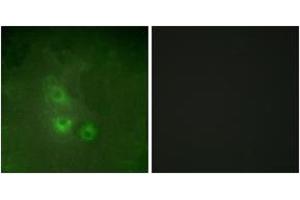 Immunofluorescence analysis of HuvEc cells, using FRK Antibody. (FRK 抗体  (AA 71-120))