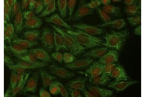 Immunocytochemistry staining of cytokeratin 18 in Hep-2 cells using mouse monoclonal antibody DA-7 ((ABIN94285), diluted 1:400), detected with GAM IgG-Alexa Fluor488 (diluted 1:200, green), cell nuclei stained with PI (1 μg/mL, orange). (Cytokeratin 18 抗体)