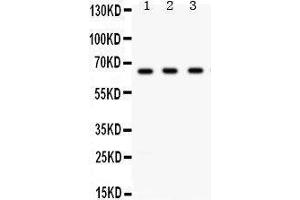 Western Blotting (WB) image for anti-Checkpoint Kinase 2 (CHEK2) (AA 465-498), (C-Term) antibody (ABIN3043811) (CHEK2 抗体  (C-Term))