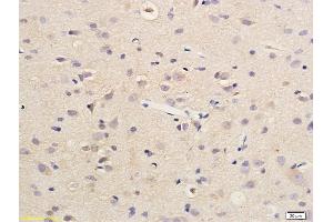 Immunohistochemistry (IHC) image for anti-Succinate Dehydrogenase Complex, Subunit D, Integral Membrane Protein (SDHD) (AA 81-159) antibody (ABIN751918)