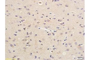 Formalin-fixed and paraffin embedded rat brain labeled with Anti SDHD Polyclonal Antibody, Unconjugated (ABIN751918) followed by conjugation to the secondary antibody and DAB staining (SDHD 抗体  (AA 81-159))