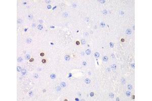 Immunohistochemistry of paraffin-embedded Rat brain using TKT Polyclonal Antibody at dilution of 1:100 (40x lens). (TKT 抗体)