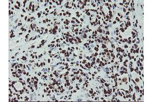 Immunohistochemical staining of paraffin-embedded Human breast tissue using anti-NONO mouse monoclonal antibody. (NONO 抗体  (AA 184-385))