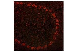 ADAM15 antibody used at a concentration of 10 ug/ml to detect cytoplasmin neurons in rodent brain (red). (ADAM15 抗体  (Middle Region))