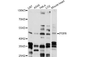 Western blot analysis of extracts of various cell lines, using PREB antibody (ABIN6291189) at 1:3000 dilution. (PREB 抗体)