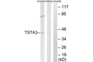 Western blot analysis of extracts from rat kidney/rat muscle cells, using TSTA3 Antibody. (TSTA3 抗体  (AA 221-270))