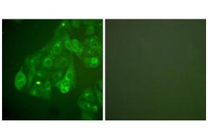 Immunofluorescence analysis of A549 cells, using Connexin 43 antibody. (Connexin 43/GJA1 抗体  (C-Term))