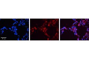SFTPB antibody - middle region          Formalin Fixed Paraffin Embedded Tissue:  Human Lung Tissue    Observed Staining:  Cytoplasm and membrane of pneumocytes   Primary Antibody Concentration:  1:600    Secondary Antibody:  Donkey anti-Rabbit-Cy3    Secondary Antibody Concentration:  1:200    Magnification:  20X    Exposure Time:  0. (SFTPB 抗体  (Middle Region))