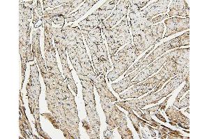 IHC analysis of ALDOA using anti-ALDOA antibody (ABIN7601907). (ALDOA 抗体  (AA 50-364))