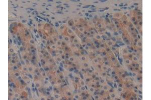 DAB staining on IHC-P; Samples: General Stomach Tissue (GIP 抗体)