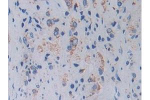Immunohistochemistry (IHC) image for anti-Topoisomerase (DNA) III alpha (TOP3A) (AA 35-179) antibody (ABIN7435616)