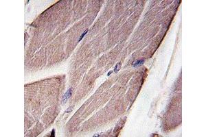IHC analysis of FFPE human skeletal muscle tissue stained with PDK4 (PDK4 抗体  (AA 250-277))