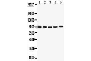 Western Blotting (WB) image for anti-Potassium Voltage-Gated Channel, Shaker-Related Subfamily, Member 4 (KCNA4) (AA 329-344), (Middle Region) antibody (ABIN3042541) (Kv1.4 抗体  (Middle Region))