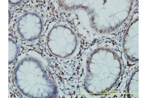 Immunostaining (ISt) image for anti-General Transcription Factor IIIC, Polypeptide 2, beta 110kDa (GTF3C2) (AA 1-911) antibody (ABIN561183)