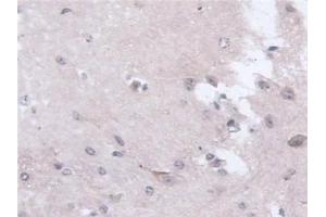 Immunohistochemistry (IHC) image for anti-N-Acetyltransferase 1 (Arylamine N-Acetyltransferase) (NAT1) (AA 9-254) antibody (ABIN7436222)