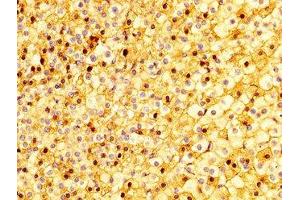 Immunohistochemistry (IHC) image for anti-Sema Domain, Immunoglobulin Domain (Ig), Transmembrane Domain (TM) and Short Cytoplasmic Domain, (Semaphorin) 4B (SEMA4B) (AA 163-253) antibody (ABIN7168797)