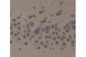 IHC-P analysis of Kidney tissue, with DAB staining. (LDOC1 抗体  (AA 18-147))