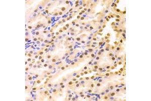 Immunohistochemistry of paraffin-embedded rat kidney using HDGF Antibody. (HDGF 抗体  (AA 1-240))