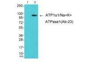Western blot analysis of extracts from K562 cells (Lane 2), using ATP1α1/Na+K+ ATPase1 (Ab-23) antiobdy. (ATP1A1 抗体  (Ser23))