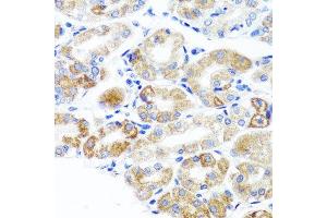 Immunohistochemistry of paraffin-embedded human stomach using DLG1 antibody at dilution of 1:100 (x40 lens). (DLG1 抗体)