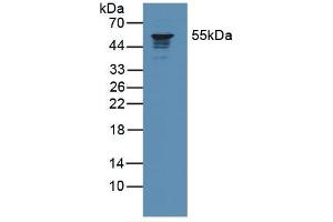 Western blot analysis of Human Jurkat Cells. (Coronin 1a 抗体  (AA 7-204))