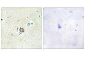 Immunohistochemistry analysis of paraffin-embedded human brain tissue using CELSR3 antibody. (CELSR3 抗体)