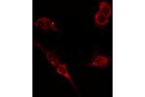 ABIN6276430 staining HepG2 cells by IF/ICC. (WASP 抗体  (Internal Region))