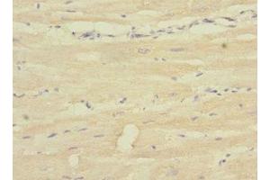 Immunohistochemistry of paraffin-embedded human heart tissue using ABIN7169499 at dilution of 1:100 (SH3D19 抗体  (AA 468-767))