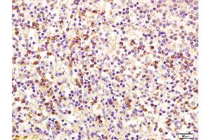 Formalin-fixed and paraffin embedded human spleen labeled with Rabbit Anti MCSF/M-CSF Polyclonal Antibody, Unconjugated (ABIN1387727) at 1:200 followed by conjugation to the secondary antibody and DAB staining (M-CSF/CSF1 抗体  (AA 201-300))
