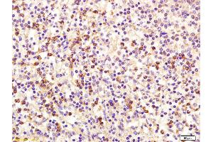 Formalin-fixed and paraffin embedded human spleen labeled with Rabbit Anti MCSF/M-CSF Polyclonal Antibody, Unconjugated (ABIN1387727) at 1:200 followed by conjugation to the secondary antibody and DAB staining