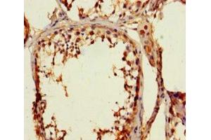 Immunohistochemistry of paraffin-embedded human testis tissue using ABIN7176521 at dilution of 1:100 (ZNF77 抗体  (AA 1-300))