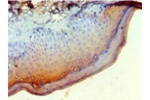 Immunohistochemistry of paraffin-embedded human skin tissue using ABIN7145570 at dilution of 1:100 (NDST1 抗体  (AA 40-556))