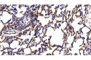 Detection of TM in Rat Lung Tissue using Polyclonal Antibody to Thrombomodulin (TM) (Thrombomodulin 抗体  (AA 31-167))